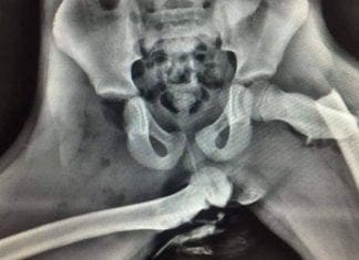 An X-ray image has been released by Dyfed Powys Police of a crash victim