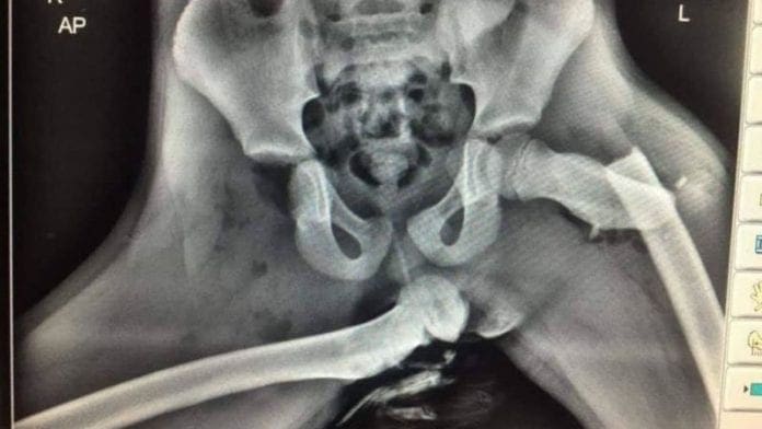 xray